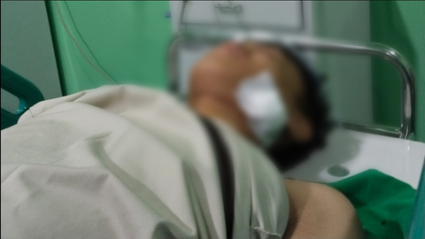 5 Pelajar Tersangka Bullying di Cikarang, Korban Patah Rahang